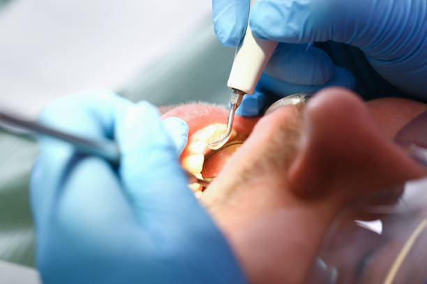 Best Broken Tooth Emergency  in Morehead, KY