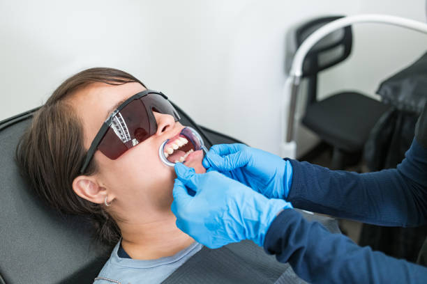 Best Chipped Tooth Repair Near Me  in Morehead, KY
