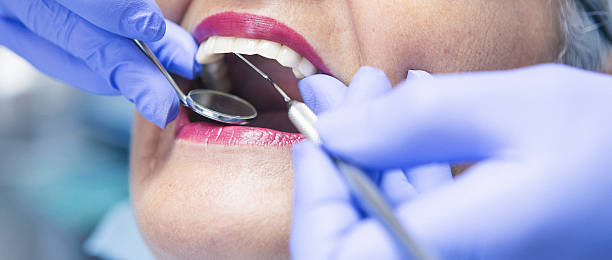 Best Emergency Dental Filling Replacement  in Morehead, KY